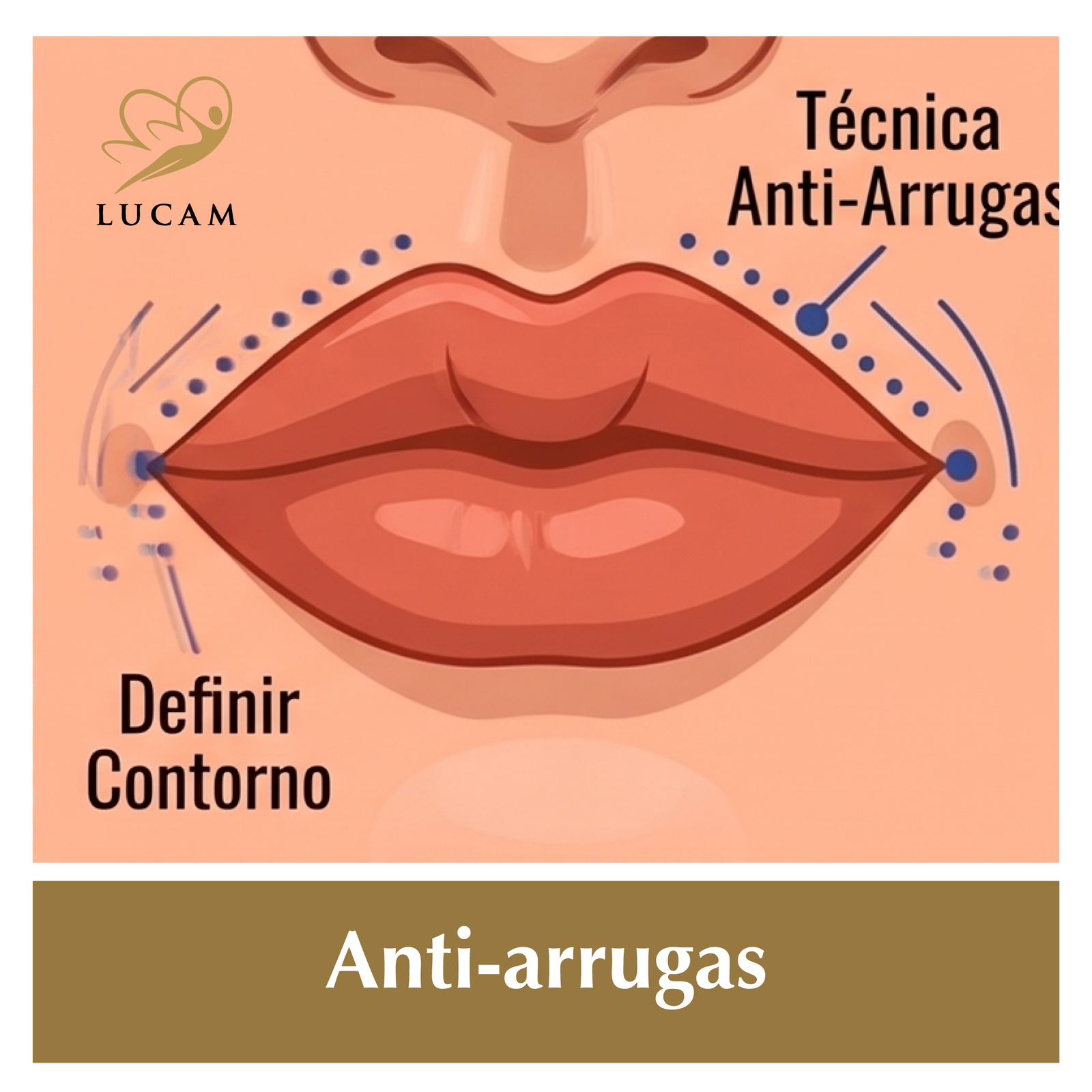 Aumento labios-en-grinon8