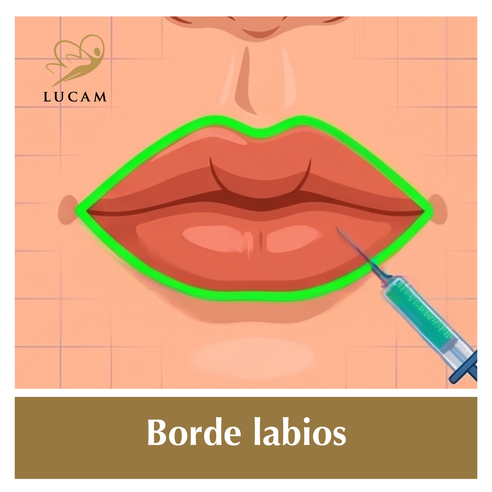 Aumento labios-en-grinon9