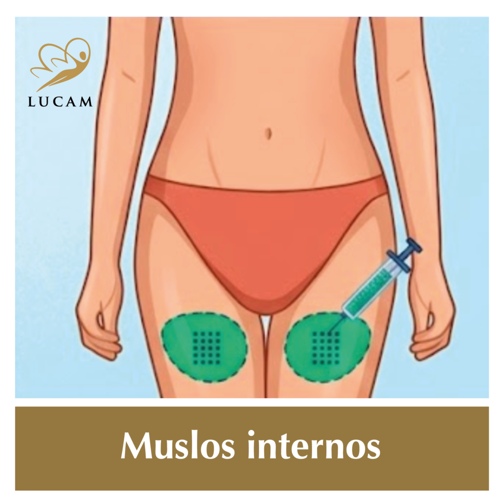 Intralipoterapia-en-grinon5