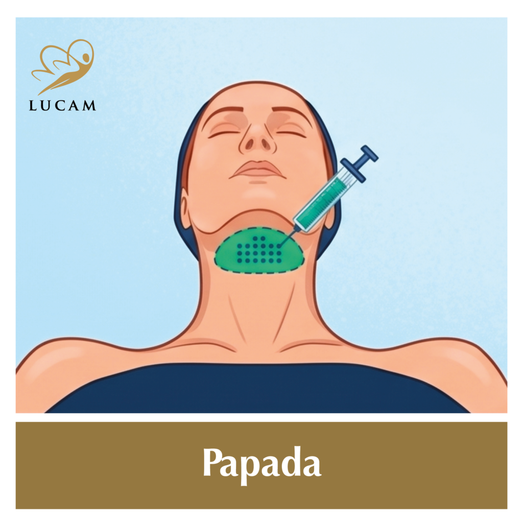 Intralipoterapia-en-grinon7